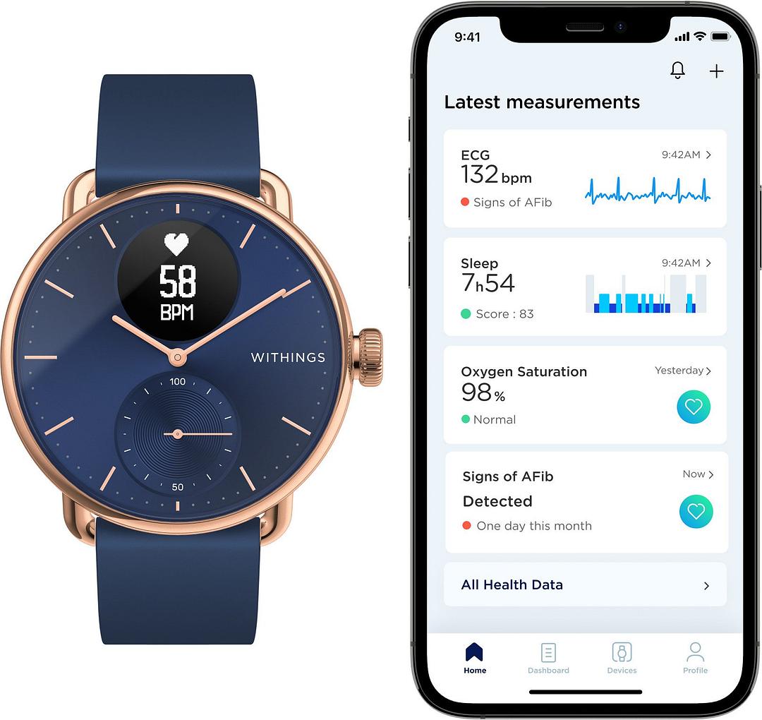 Withings Hybrid Scanwatch ECG 38mm Rose Gold/Blue - Smartech.ee